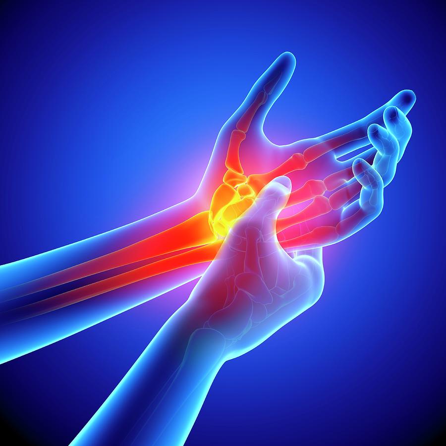 1-wrist-pain-pixologicstudioscience-photo-library